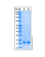 Recombinant Human IL-4 Protein rp147593-10μg Aladdin