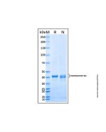 Recombinant Human CCDC104 Protein rp189314-10μg Aladdin