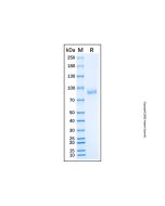 Recombinant Human alpha-L-Iduronidase/IDUA Protein rp181246-10μg Aladdin
