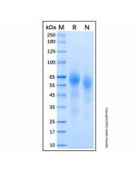 Recombinant Human PSAP Protein rp188415-10μg Aladdin
