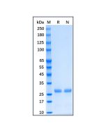 Recombinant Human Bcl-XL Protein rp175902-10μg Aladdin