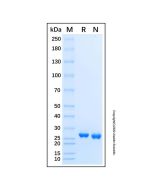 Recombinant Human DGCR6L Protein rp189386-10μg Aladdin