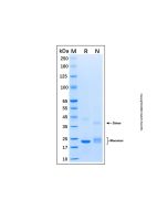 Recombinant Human USAG1 Protein rp184936-10μg Aladdin