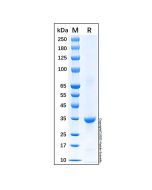 Recombinant Human Cyclin D1 Protein rp156643-10μg Aladdin