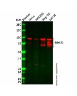 Recombinant DDX21 Antibody - Primary antibody, specific to Recombinant DDX21, Rabbit IgG Ab099417-10μl Aladdin