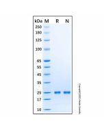 Recombinant Human UBCH6/UBE2E1 Protein rp184864-10μg Aladdin