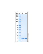 Recombinant Human GMFB Protein rp183586-10μg Aladdin