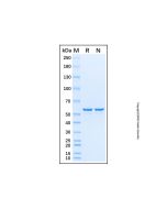 Recombinant Human TCF3/E2A Protein rp220432-10μg Aladdin
