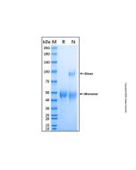Recombinant Human TPST1 Protein rp152594-10μg Aladdin