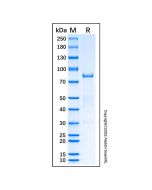 Recombinant Human SDHA Protein rp220576-10μg Aladdin