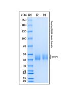 Recombinant Human IGFBP-3 Protein rp222573-10μg Aladdin