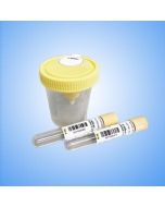 Urine DNA Storage Tube CWX022M