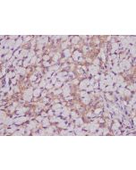 CEACAM-1/CD66a Polyclonal Antibody (AN005960L) elabscience