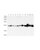 SOD2 Polyclonal Antibody (AN006910L) elabscience