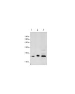CTSB Polyclonal Antibody (AN006970L) elabscience