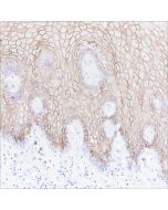 Recombinant CD138/Syndecan-1 Monoclonal Antibody (AN301463L) elabscience