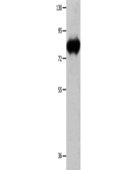 ECE1 Polyclonal Antibody (E-AB-10296) elabscience