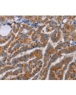 ALG9 Polyclonal Antibody (E-AB-10773) elabscience