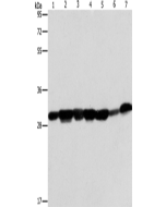 AK2 Polyclonal Antibody (E-AB-10926) elabscience