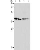 BCAT2 Polyclonal Antibody (E-AB-10996) elabscience