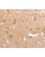 CASP12 Polyclonal Antibody (E-AB-12302) elabscience