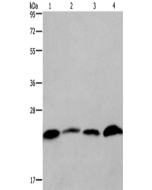 CMTM6 Polyclonal Antibody (E-AB-12450) elabscience