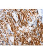 SHROOM2 Polyclonal Antibody (E-AB-12982) elabscience