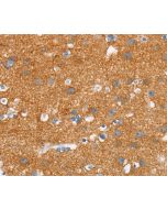 SNCA Polyclonal Antibody (E-AB-13070) elabscience