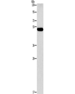 CALCRL Polyclonal Antibody (E-AB-13173) elabscience