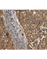 CSTB Polyclonal Antibody (E-AB-13179) elabscience