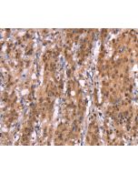 AMER1 Polyclonal Antibody (E-AB-13234) elabscience