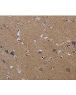 PIK3CG Polyclonal Antibody (E-AB-13516) elabscience