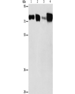 ACSL4 Polyclonal Antibody (E-AB-14661) elabscience