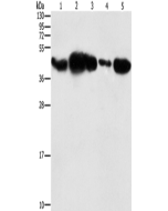 PGK2 Polyclonal Antibody (E-AB-14681) elabscience