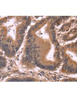 CCDC106 Polyclonal Antibody (E-AB-14831) elabscience