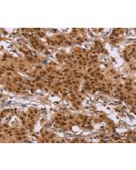 CTNNBL1 Polyclonal Antibody (E-AB-14901) elabscience