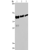 FASTKD2 Polyclonal Antibody (E-AB-15022) elabscience