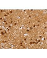 ZMAT3 Polyclonal Antibody (E-AB-15278) elabscience