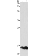 PFN1 Polyclonal Antibody (E-AB-15827) elabscience