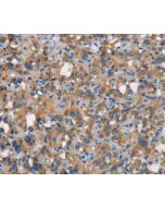 CEACAM6 Polyclonal Antibody (E-AB-15980) elabscience