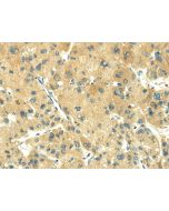 TRIM10 Polyclonal Antibody (E-AB-17091) elabscience