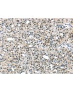 TRIP6 Polyclonal Antibody (E-AB-17157) elabscience