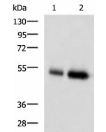 BMP5 Polyclonal Antibody (E-AB-17735) elabscience