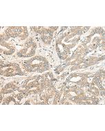 PCDHGB5 Polyclonal Antibody (E-AB-17857) elabscience