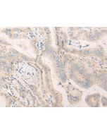 ELANE Polyclonal Antibody (E-AB-17904) elabscience