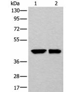 DLK1 Polyclonal Antibody (E-AB-18225) elabscience