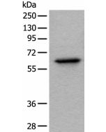 BAIAP2L1 Polyclonal Antibody (E-AB-18531) elabscience