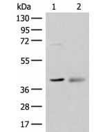 ADH5 Polyclonal Antibody (E-AB-18823) elabscience