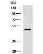 PAX2 Polyclonal Antibody (E-AB-19302) elabscience