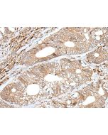 ENPEP Polyclonal Antibody (E-AB-19620) elabscience